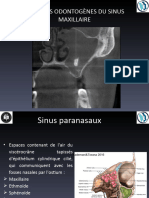 La Pathologie Du Sinus Maxillaire