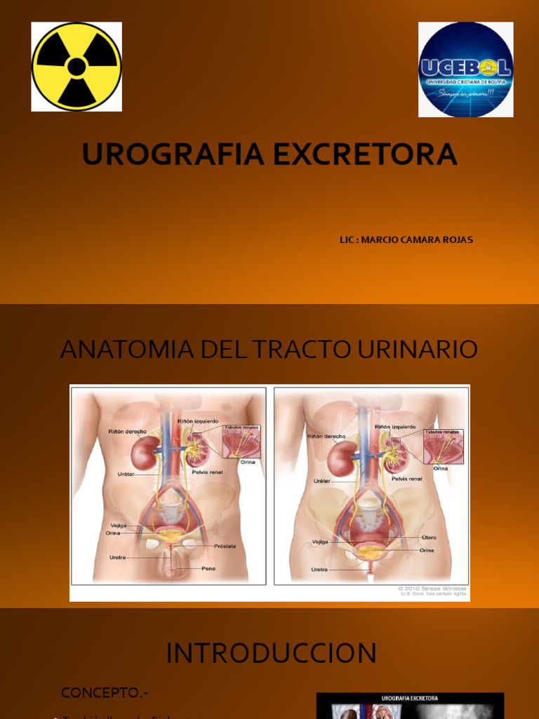 Urografía Excretora: Indicaciones y Usos | PDF
