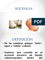 Hidrocefalia Presentacion