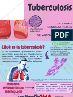 Tuberculosis