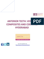 Anterior Teeth Veneers Hyderabad
