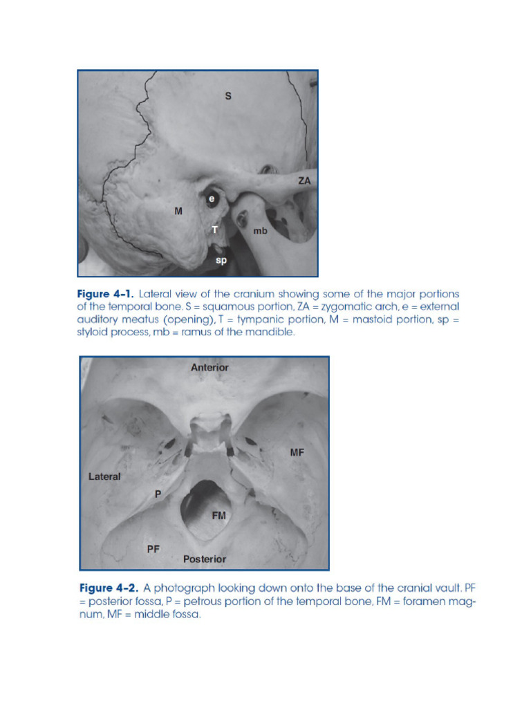 Functional Anatomy of The Cochlea Images | PDF