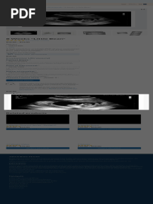 8 Weeks Little Bean Fake Ultrasound W Instant Download!