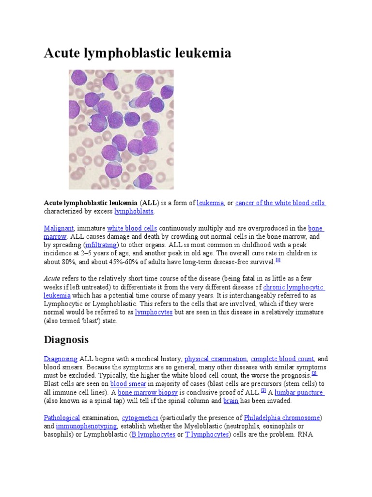 Acute Lymphoblastic Leukemia Overview | PDF | Leukemia | Chemotherapy