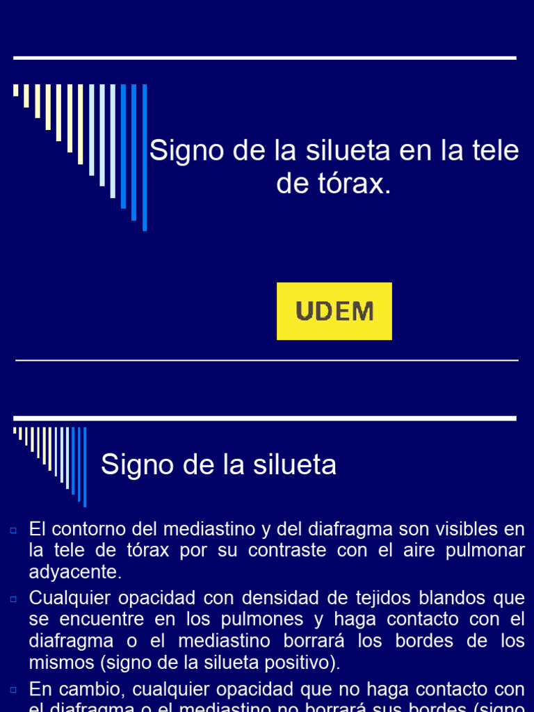 Signo de la Silueta en Radiografías de Tórax | PDF | Pulmón | Neumonía