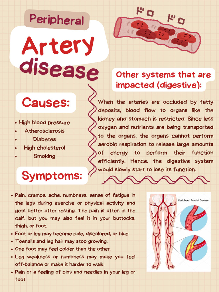 Understanding Peripheral Artery Disease | PDF | Artery | Angiology