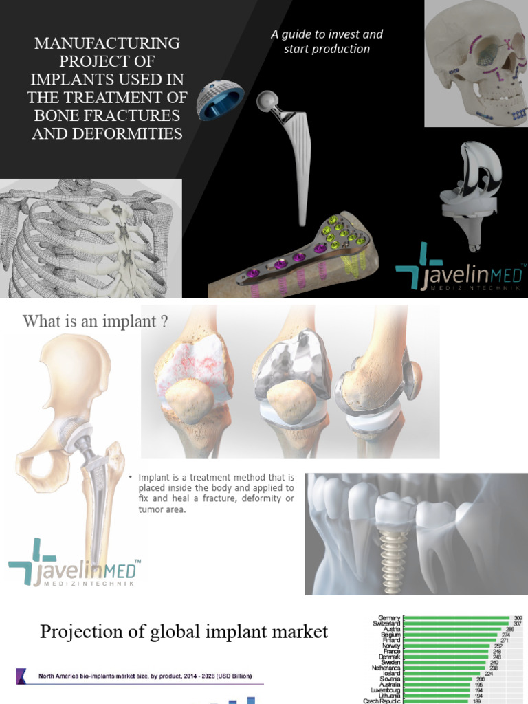 Implant Manufacturing Investment Guide | PDF | Numerical Control ...