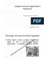 Részleges Lemezes Fogpótlások - Alaplemez