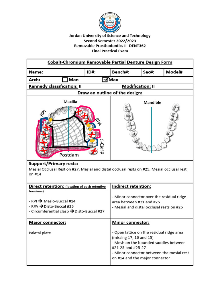 Cobalt-Chromium Partial Denture Design | PDF | Dental Anatomy ...