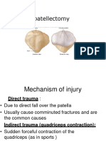 Pateelaectomy
