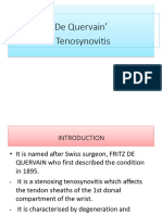 Tenosynovitis