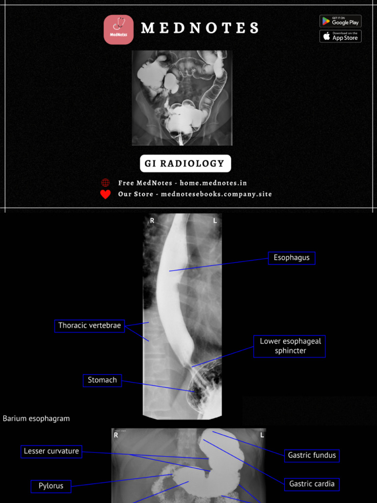 GI Radiology MedNotes 1 8 | PDF