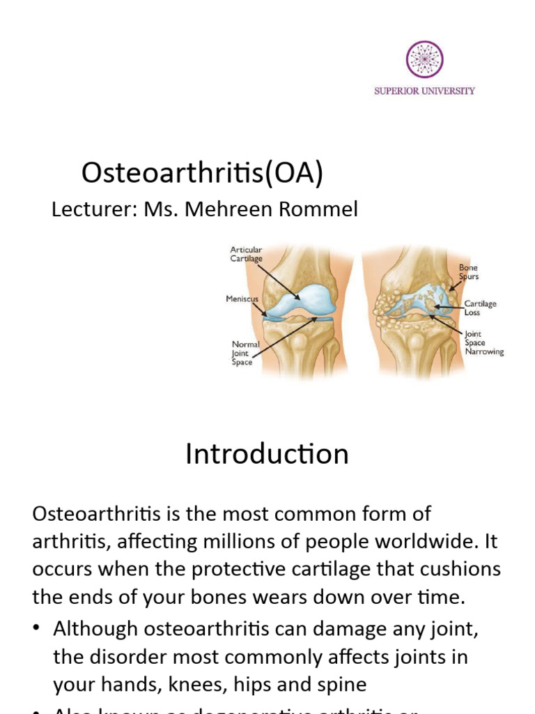 Osteoarthritis Pdf Osteoarthritis Joint
