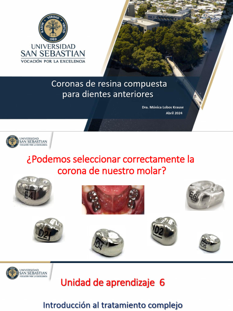 Clase Coronas de Composite 2024 | PDF | Diente humano | Esmalte de dientes