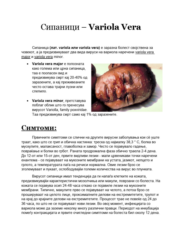 Сипаници | PDF