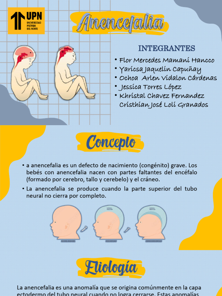 Anencefalia: Causas y Prevención | PDF | Especialidades Medicas | Anatomía