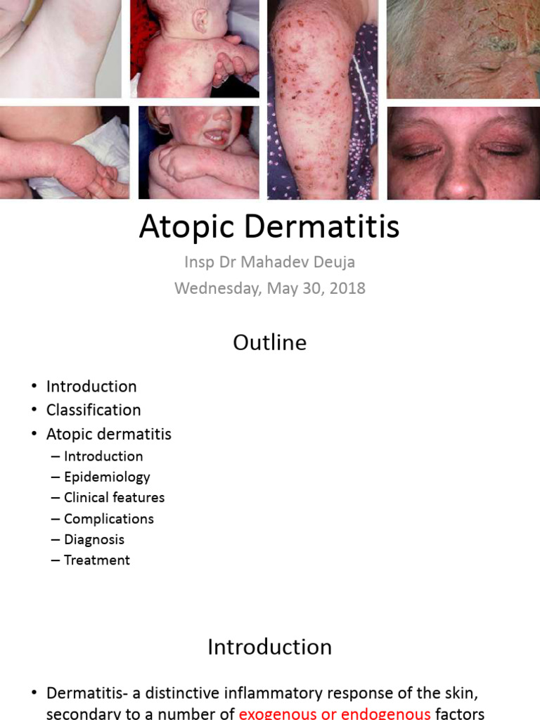 Understanding Numullar Dermatitis | PDF | Dermatitis | Skin