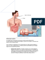 Diagnostico de Las Erges