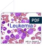 Leukemia