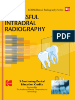 XRAY - Successful IO Radiographs - Kodak