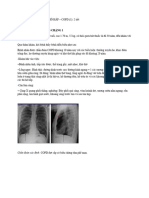 CÂU 3 CHẶNG 1 CASE COPD