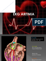 ECG ARITMIA (Repaired)