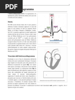 ECG