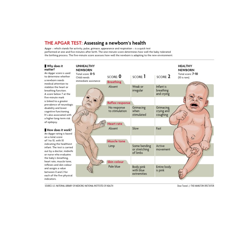 Apgar Test: Newborn Health Assessment | PDF | Wellness | Science ...