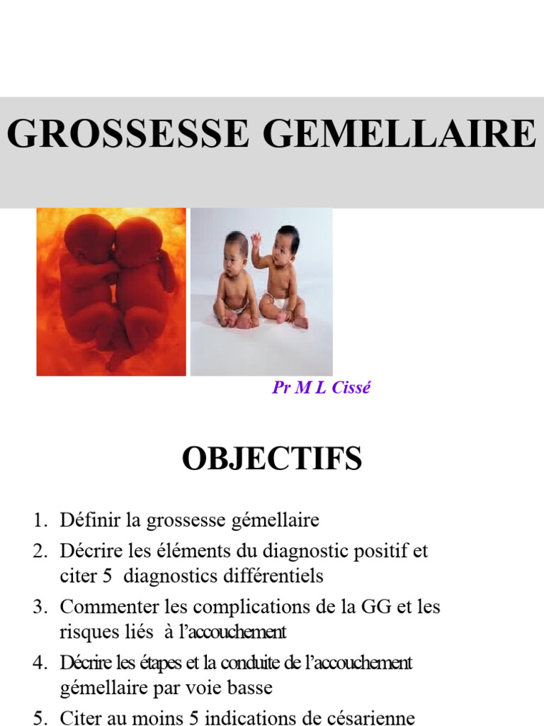 Complications et Accouchement Gémellaire PDF Jumeau Accouchement — free download