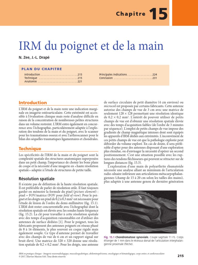 IRM du Poignet et de la Main: Techniques et Indications | PDF | Main ...
