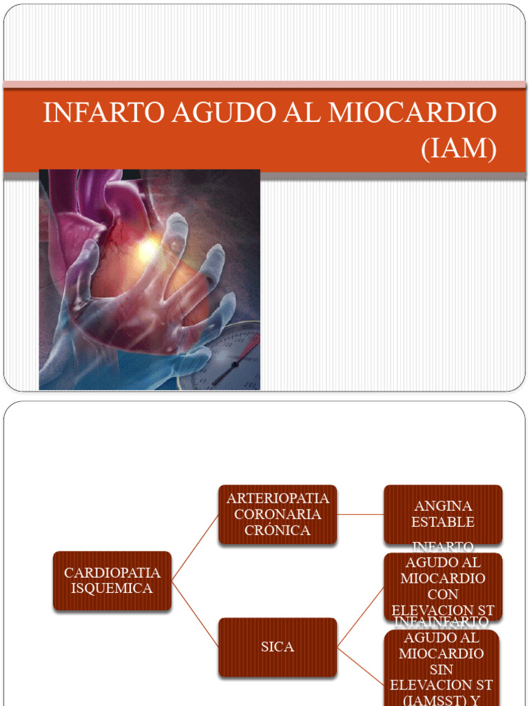 Infarto Agudo Al Miocardio | PDF | Infarto de miocardio | Isquemia