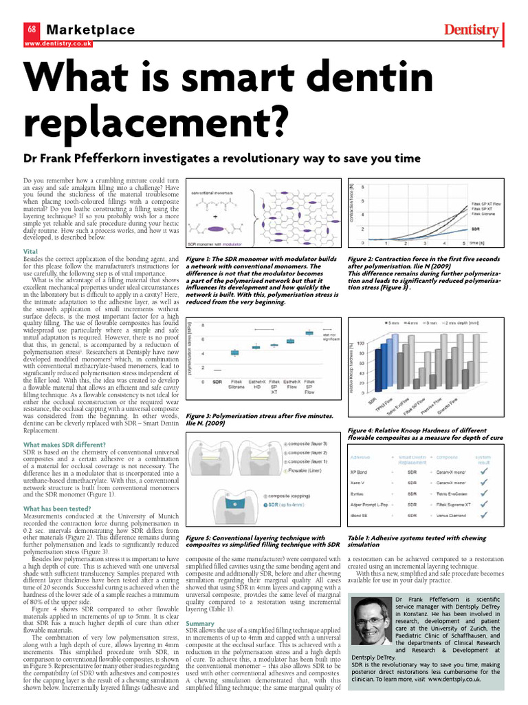 Simplified SDR Technique for Fillings | PDF | Composite Material ...