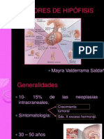 ADENOMA D EHIPOFISIIS