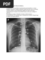 Radiografía Normal de Tórax: Anatomía y Criterios | PDF | Tórax | Pulmón