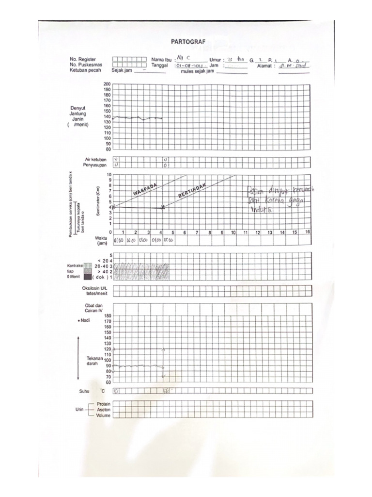 PARTOGRAF | PDF