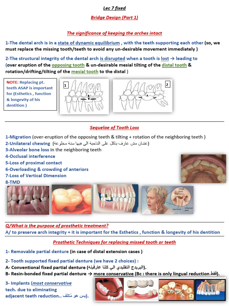 Lec 7 Fixed-1 | PDF | Dental Implant | Tooth