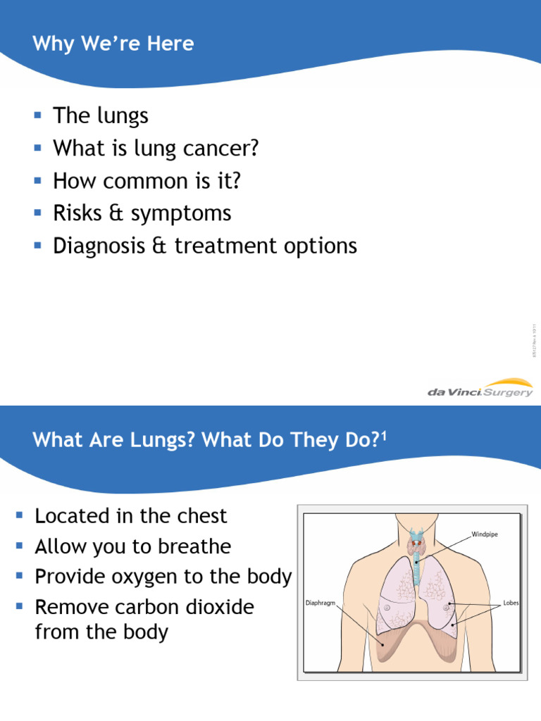Lung Cancer: Diagnosis and Treatment Guide | PDF | Lung Cancer | Cancer