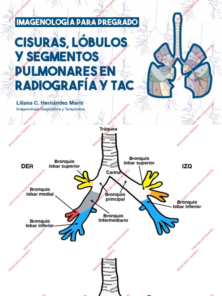 Cisuras y Segmentos Pulmonares en Rx y TAC | PDF | Pulmón | Tórax ...