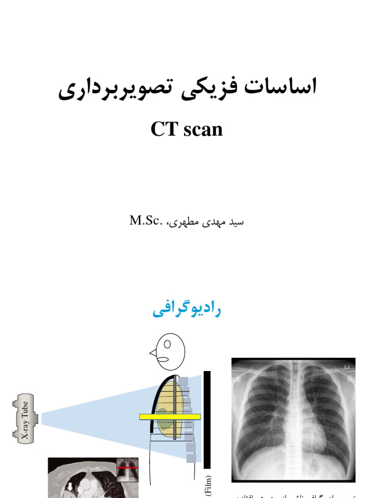 CT Scan For Curative Medicine - 113107 | PDF