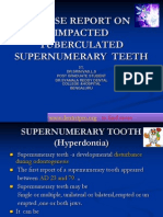 Case Report on Impacted Supernumerary Teeth