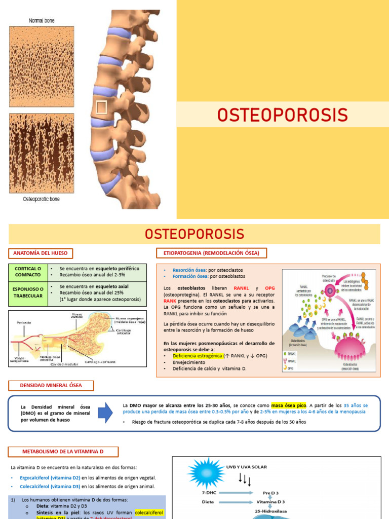 Guía Completa sobre Osteoporosis | PDF | Osteoporosis | Hueso