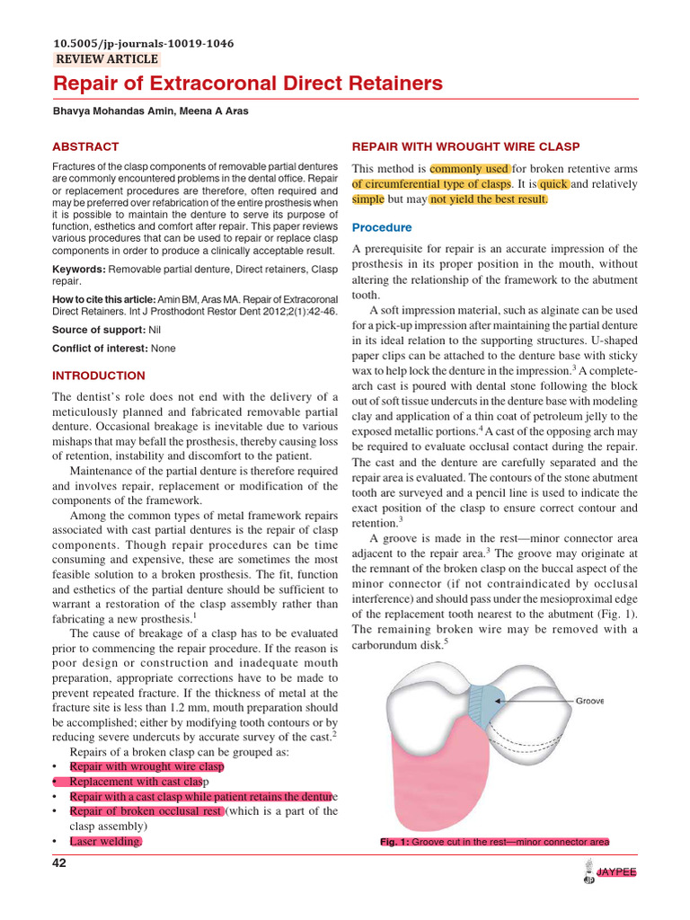 Repair20of20Extracoronal20Direct20Retainers Compressed | PDF | Dentures ...