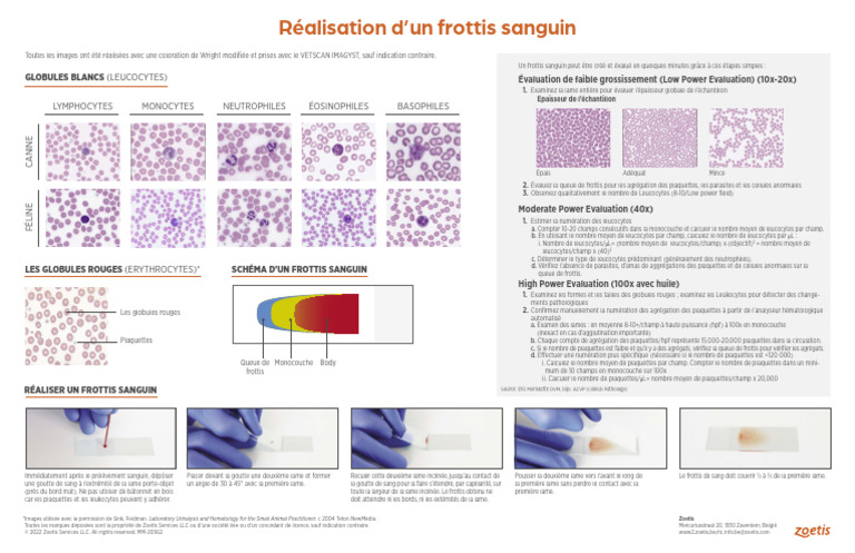 Interprétation du frottis sanguin | PDF | Globule blanc | Médecine clinique