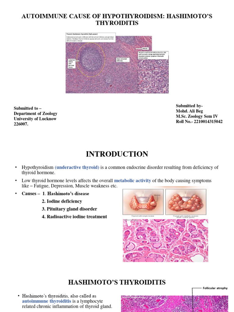 Hashimoto's Disease and Its Notes | PDF | Thyroid | Hypothyroidism