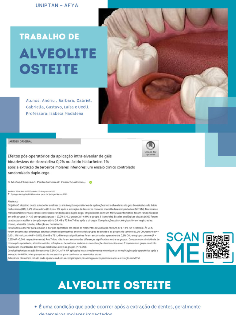 Tratamento da Alveolite Pós-Extração Dentária | PDF | Dente humano ...