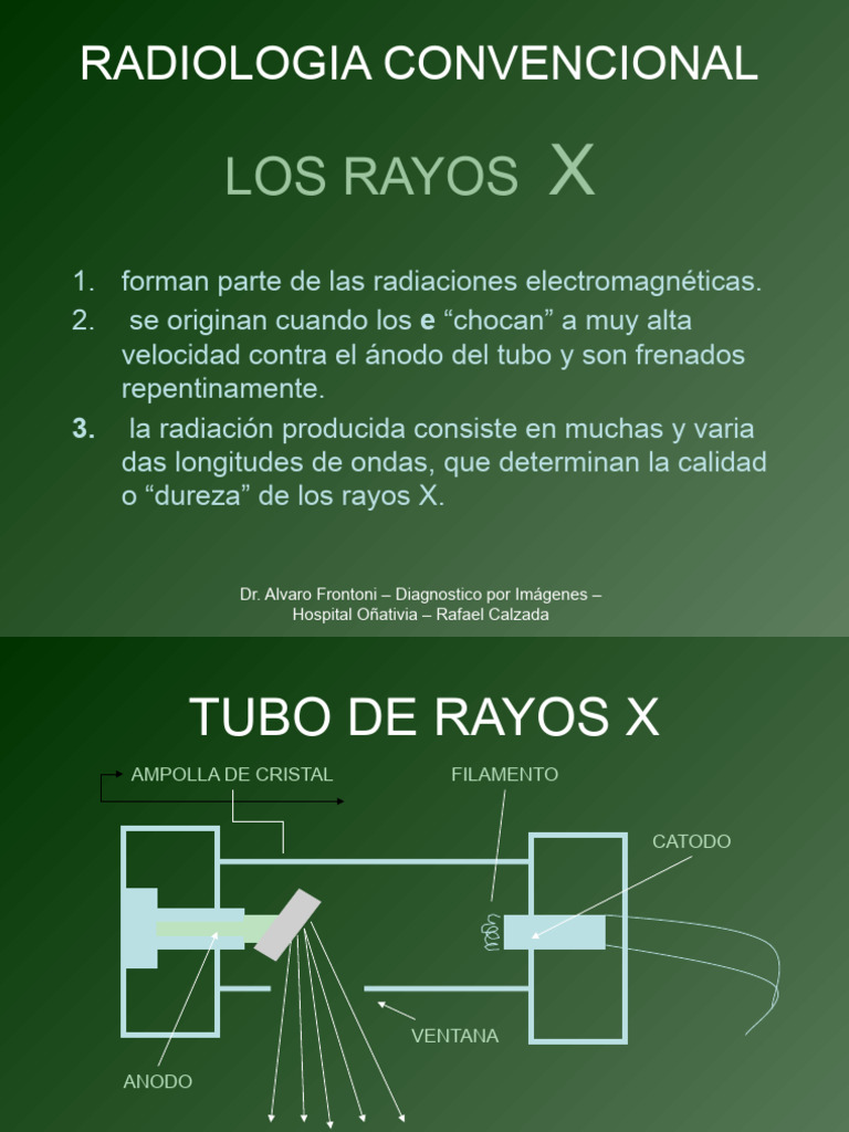 Rayos X y Diagnóstico Pulmonar | PDF | Rayo X | Pulmón