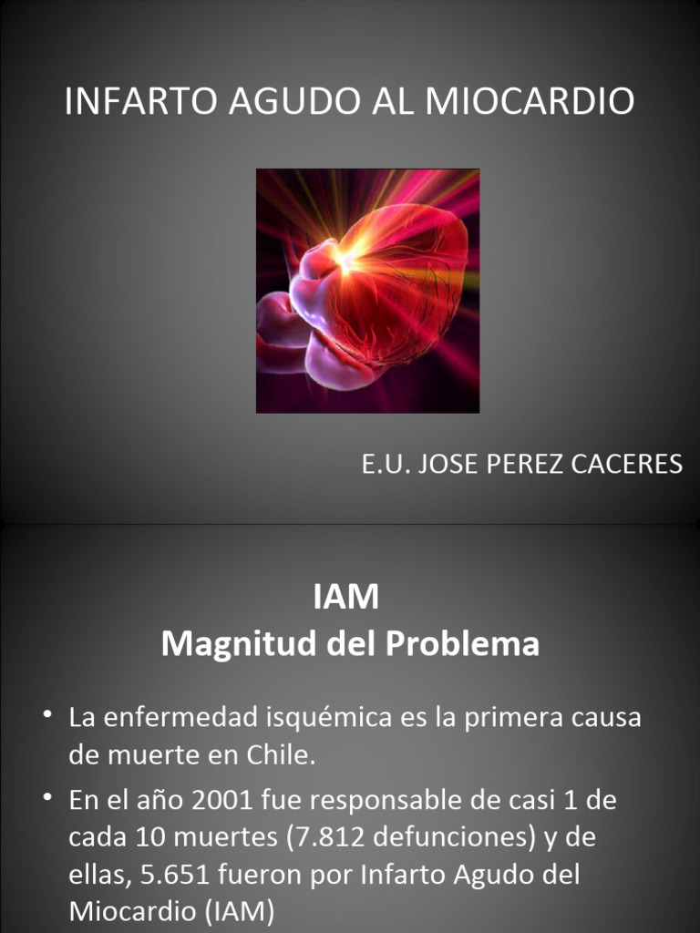 IAM mirada de la enfermeria | PDF | Infarto de miocardio | Isquemia