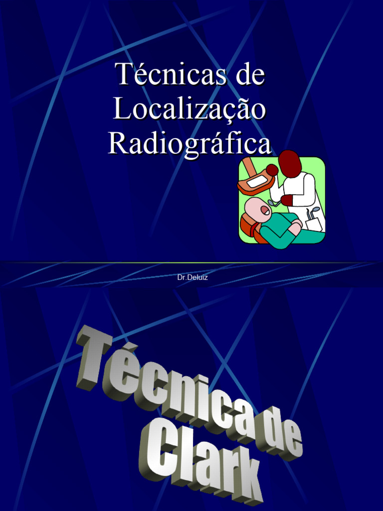 Técnica De Clark Pdf