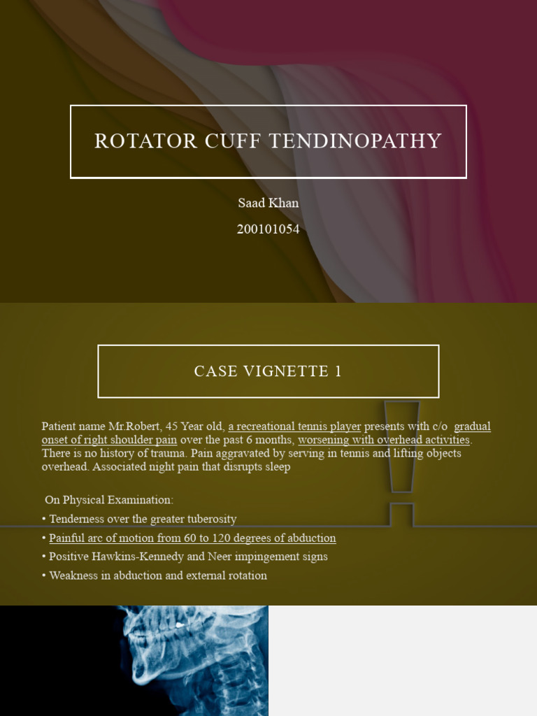 Rotator Cuff Tendinopathy | Download Free PDF | Shoulder | Diseases And ...