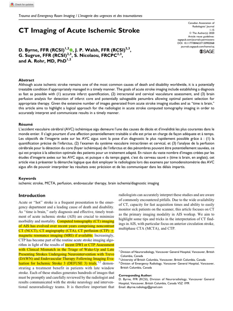 Byrne, CT Imaging of Acute Ischemic Stroke | PDF | Ct Scan | Stroke
